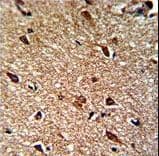 IDH1 / IDH Antibody (aa63-90)