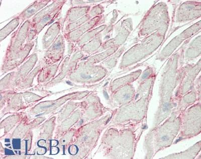 IHC-plus™ TMIGD2 Antibody (aa119-147)