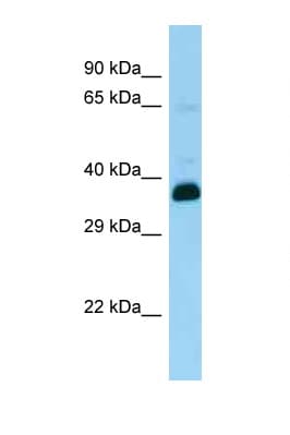 SNUPN Antibody (aa24-73)