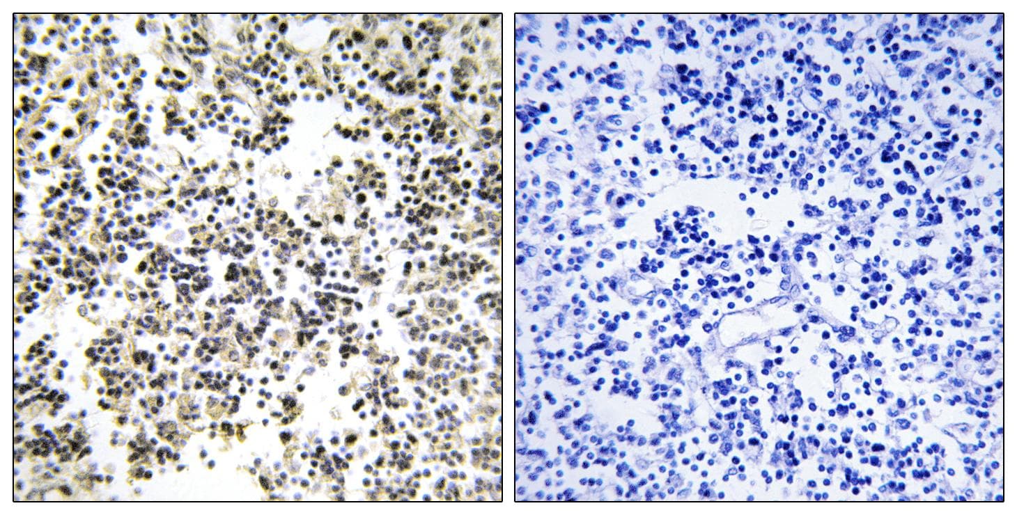 Polyclonal Rabbit anti-Human IGLL1 / CD179b Antibody (IHC)