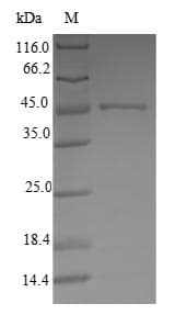 Human ATP5H Protein (Recombinant GST, N-terminus)