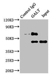 GALT Antibody