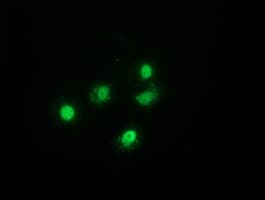 H6PD / G6PDH Antibody (clone OTI3H5)
