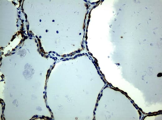 KRT19 / CK19 / Cytokeratin 19 Antibody (aa240-390, clone UMAB2)