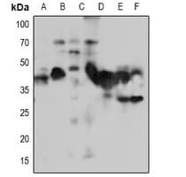 NACA Antibody