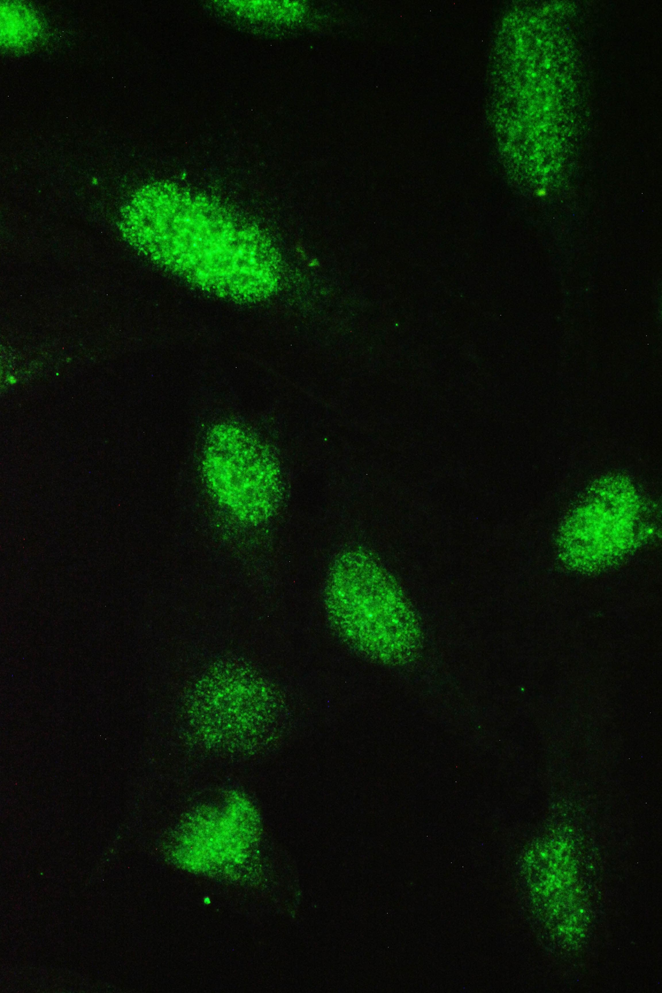 Polyclonal Rabbit anti-Human PAX5 Antibody (IHC, WB)