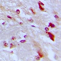 CEBPD + CEBPE Antibody