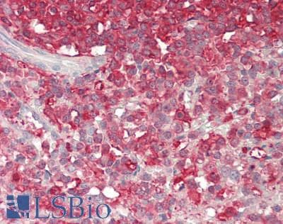 PCSK9 Antibody (aa454-679)