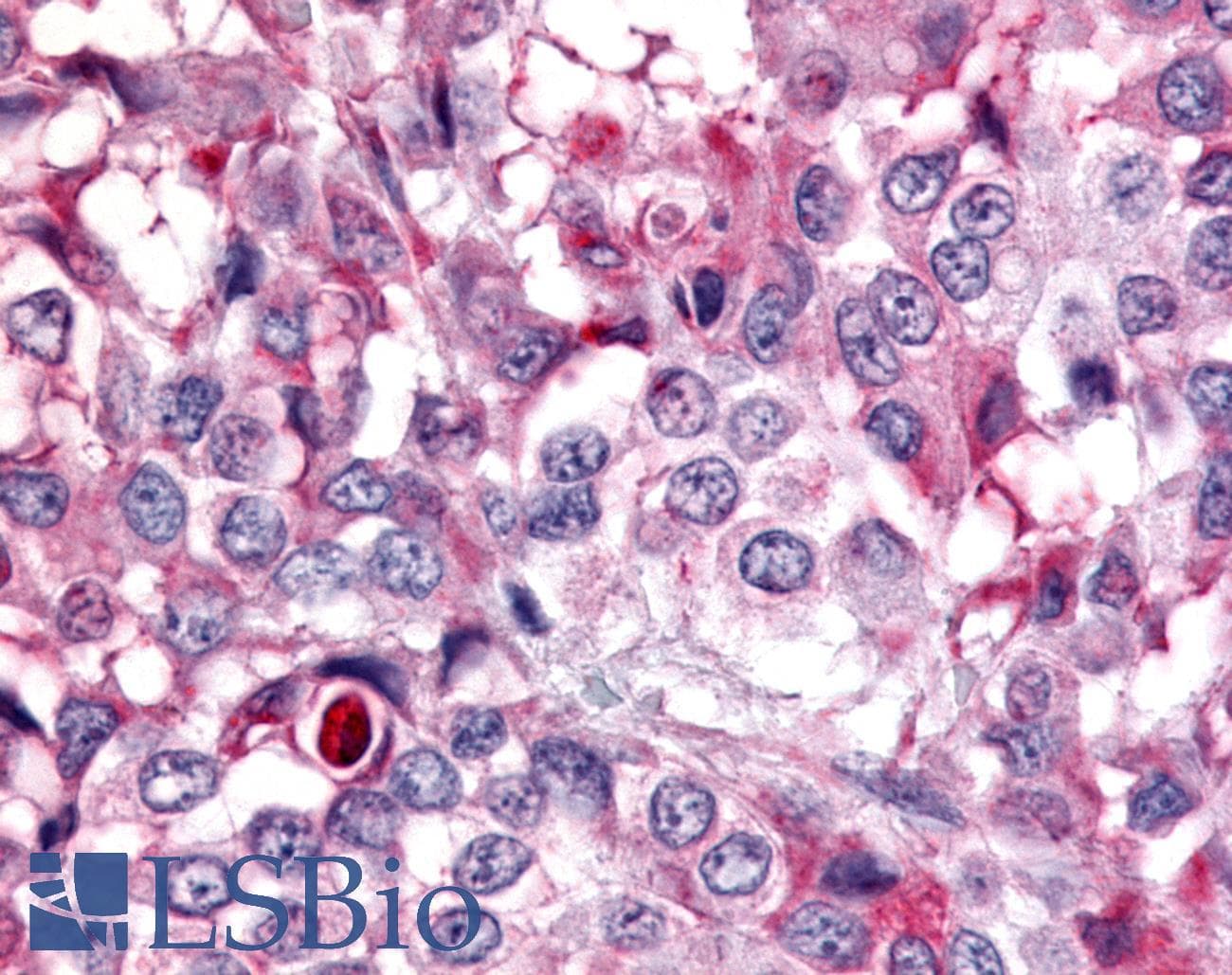 PathPlus™ PTPRE / PTP Epsilon Antibody (Cytoplasmic Domain)
