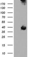 Monoclonal Mouse anti-Human MAP2K3 / MEK3 / MKK3 Antibody (clone OTI1B5, IHC, IF, WB)