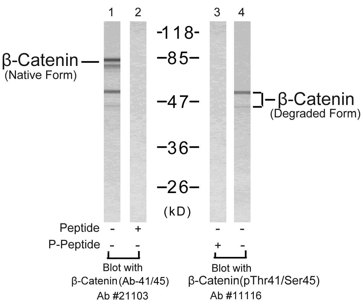 Polyclonal Rabbit anti-Human CTNNB1 / Beta Catenin Antibody (p41/45, WB)