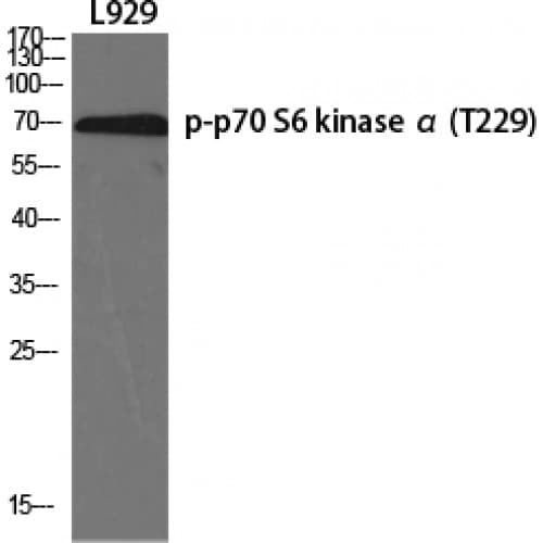 RPS6KB1 / P70S6K / S6K Antibody (170-250 aa)