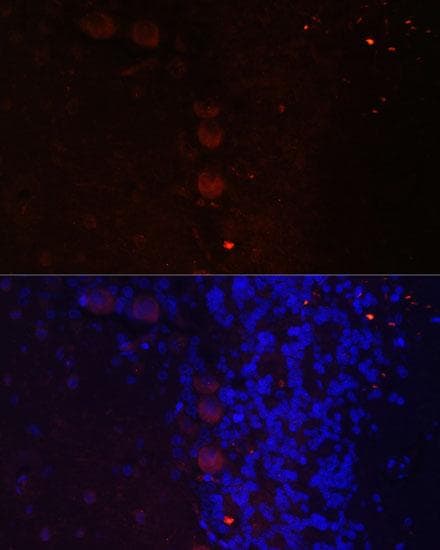 NEFM / NF-M Antibody
