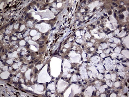 Monoclonal Mouse anti-Human PRX-1 / PRRX1 Antibody (clone OTI6A4, IHC, WB)