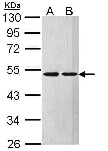 ASL / Argininosuccinate Lyase Antibody (aa13-261)