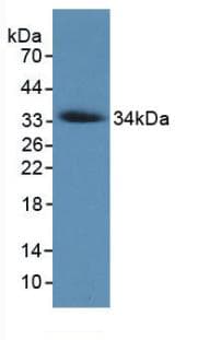 Collagen VII Antibody