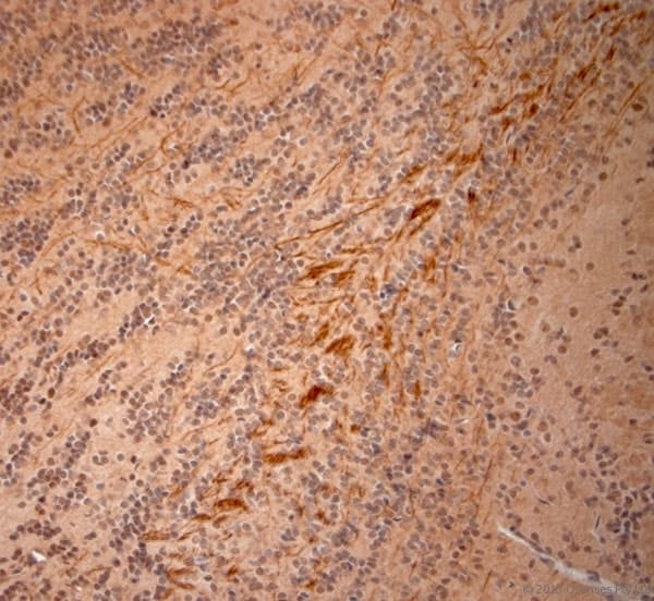 NEFH / NF-H Antibody (aa150-200)