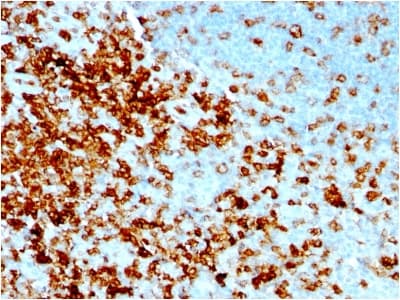 Recombinant Monoclonal Mouse anti-Human SPN / CD43 Antibody (clone rSPN/1094, IHC, IF, WB)