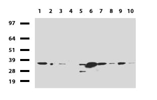 Monoclonal Mouse anti-Human HADH Antibody (clone UMAB151, aa57-314, IHC, WB)
