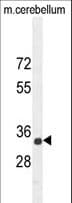 SYNCAM / CADM1 Antibody (aa66-94)
