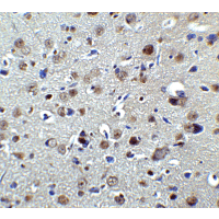 Polyclonal Rabbit anti-Human PLAGL2 Antibody (IHC, IF, WB)