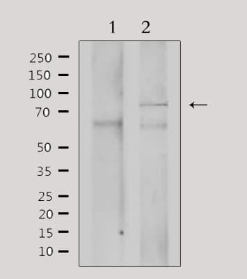 ADRBK2 / GRK3 Antibody