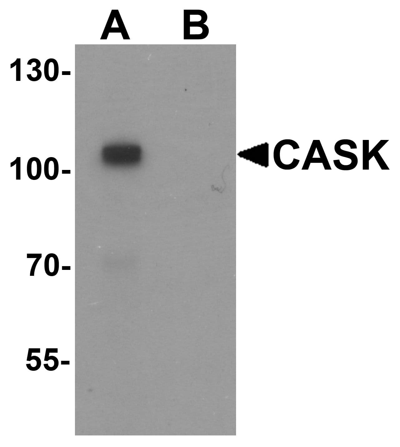 IHC-plus™ CASK Antibody