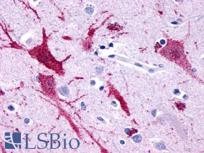 PathPlus™ Polyclonal Rabbit anti-Human ADGRF5 / GPR116 Antibody (Cytoplasmic Domain, IHC)