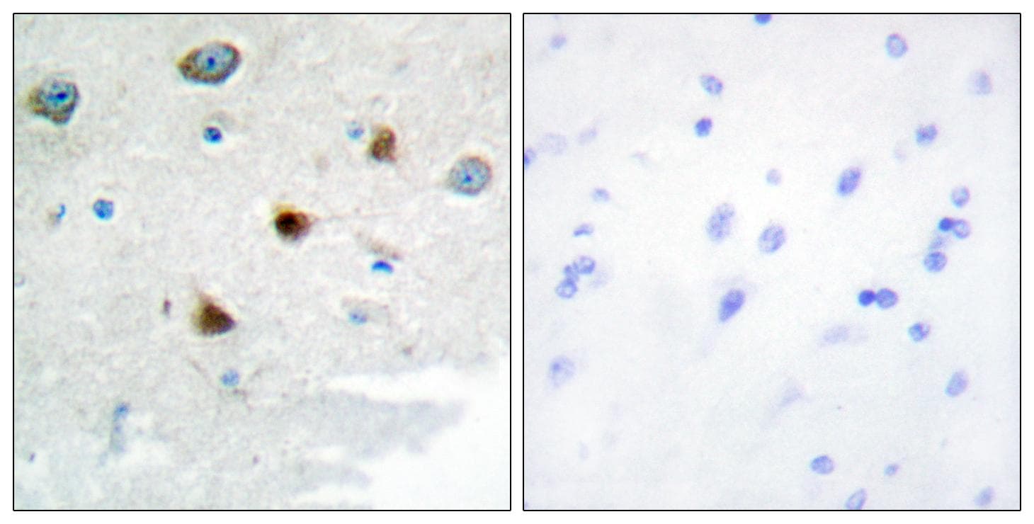 DUS4L Antibody