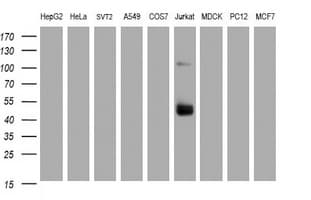 Monoclonal Mouse anti-Human CD2 Antibody (clone OTI3E11, IHC, WB)