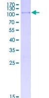 Human SMAD6 Protein (Recombinant GST)