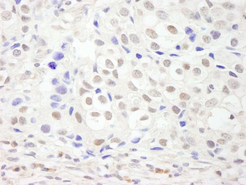 GTF3C3 Antibody (aa475-525)