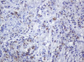 CD79A / CD79 Alpha Antibody (clone OTI5E2, Carrier-free)