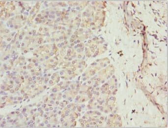 Polyclonal Rabbit anti-Human RAB5C Antibody (IHC)