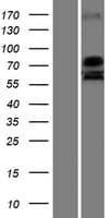 USP51 Protein (Over-Expression Lysate Myc-DDK (Flag))