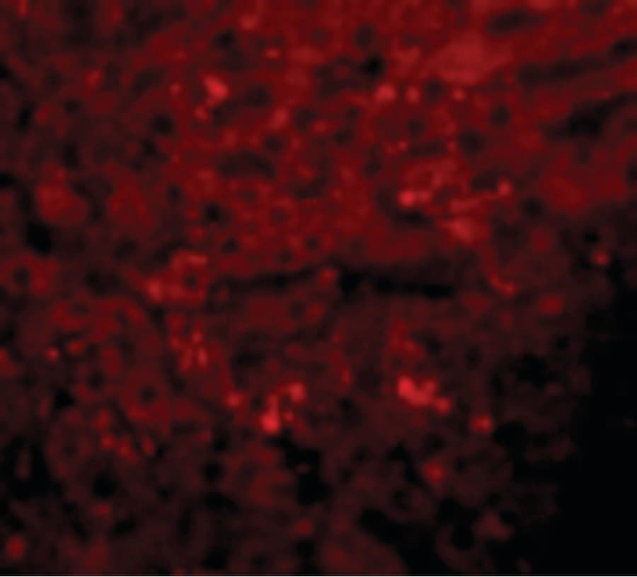 KDM3A / JMJD1A Antibody