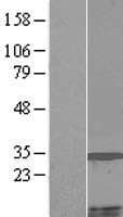 MCCD1 Protein (Over-Expression Lysate Myc-DDK (Flag))