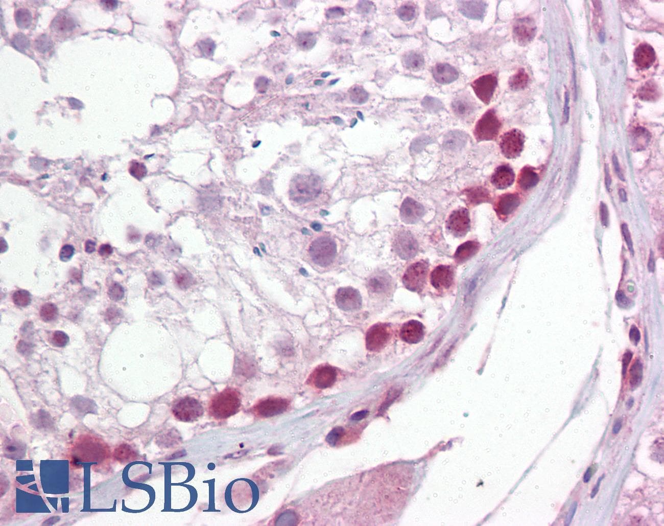 IHC-plus™ UNG / Uracil DNA Glycosylase Antibody (aa281-298)