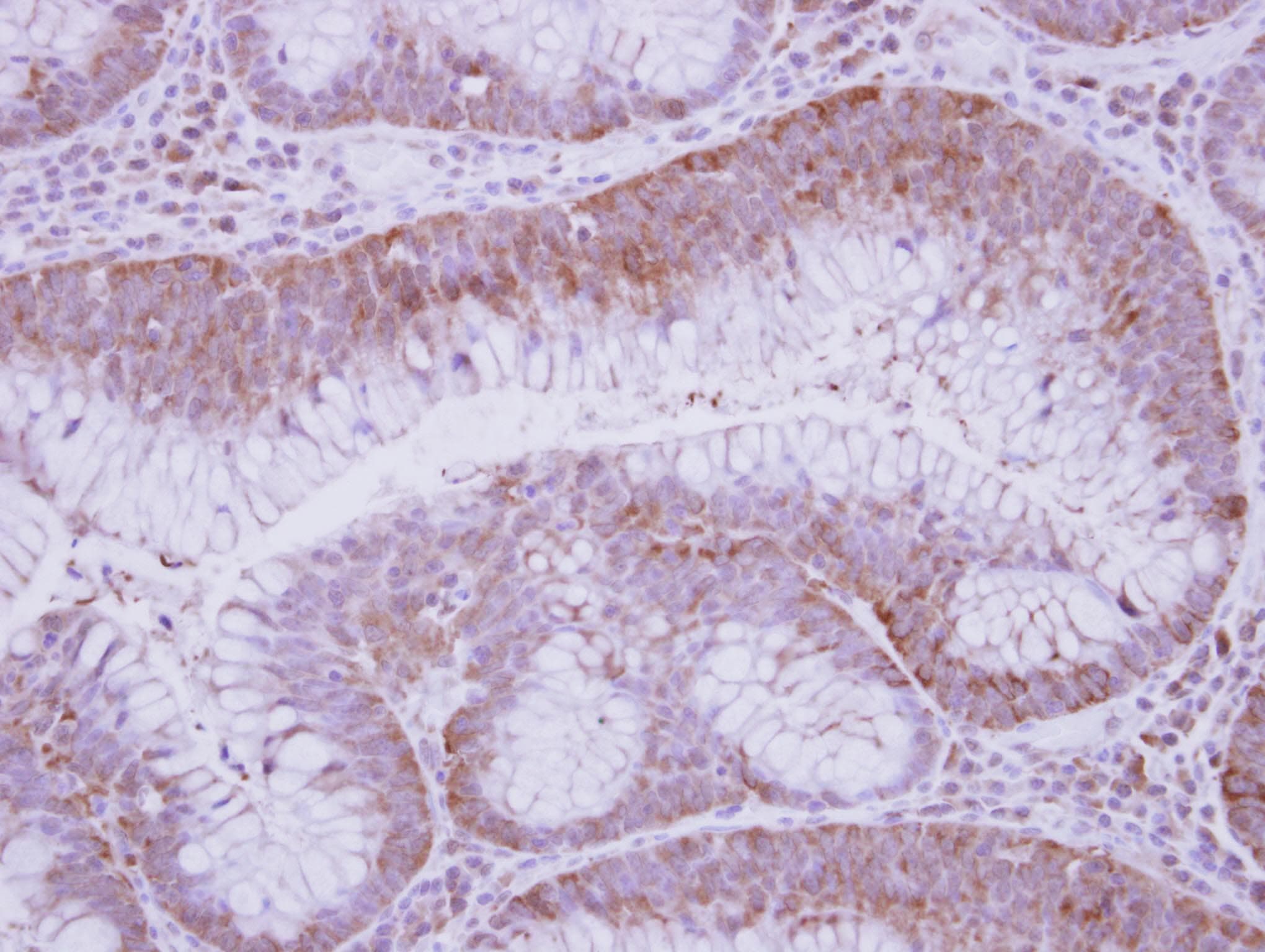 GFOD2 Antibody