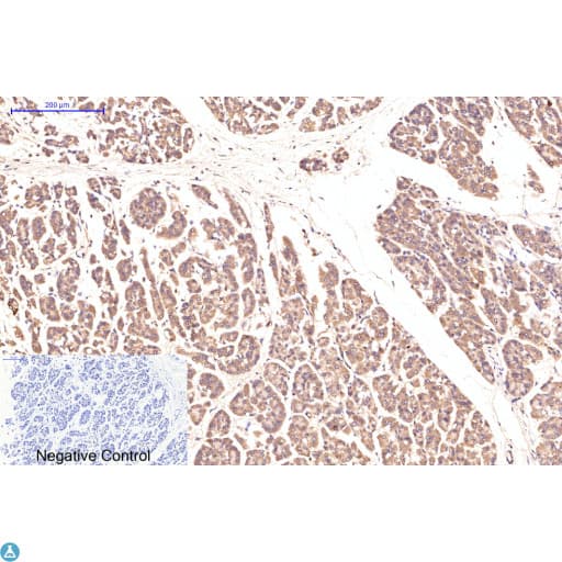 APG5 / ATG5 Antibody