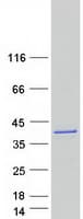 Human LASP1 Protein (Recombinant Myc-DDK (Flag))
