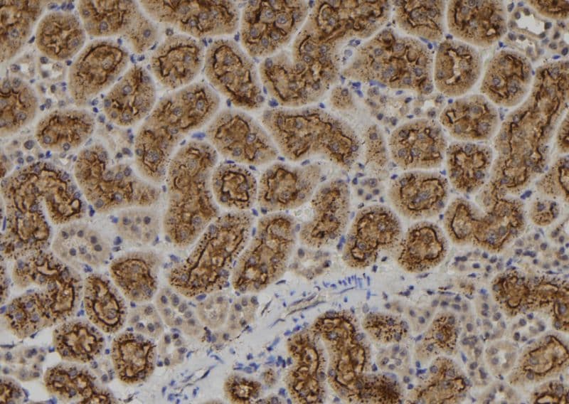 Polyclonal Rabbit anti-Human IKZF1 / IKAROS Antibody (IHC, WB)