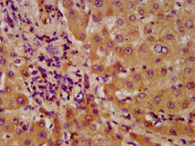 Polyclonal Rabbit anti-Human NUDT5 Antibody (IHC, IF)