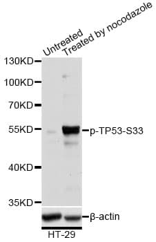 Polyclonal Rabbit anti-Human TP53 / p53 Antibody (phospho-Ser33, WB)