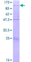 Human ZNF16 Protein (Recombinant GST)