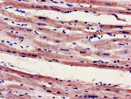 Polyclonal Rabbit anti-Human FILIP1 Antibody (IHC, IF)