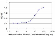 CACNA1F / Cav1.4 Antibody (clone 3B2)