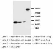 IL-1B / IL-1 Beta Antibody (aa249-269)