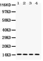 LGALS1 / Galectin 1 Antibody