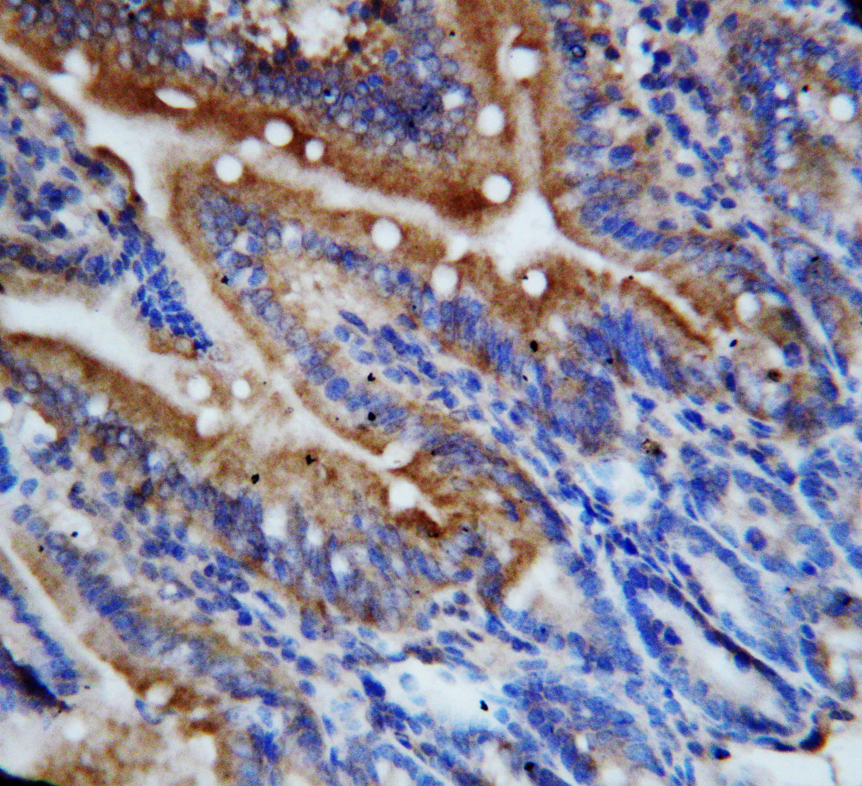 Polyclonal Rabbit anti-Mouse CX3CL1 / Fractalkine Antibody (aa74-92, IHC, WB)